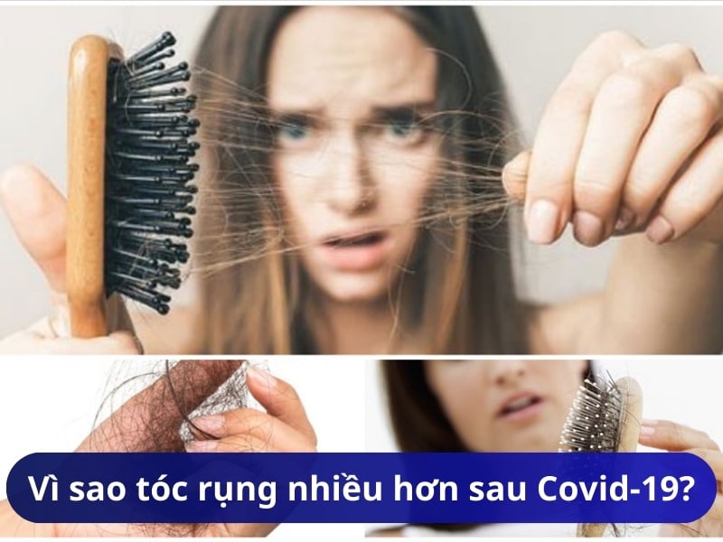 Vì sao tóc rụng nhiều hơn sau khi khỏi Covid-19?