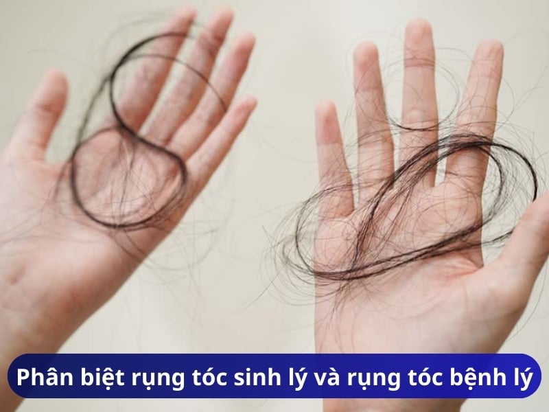 Phân biệt rụng tóc sinh lý và rụng tóc bệnh lý