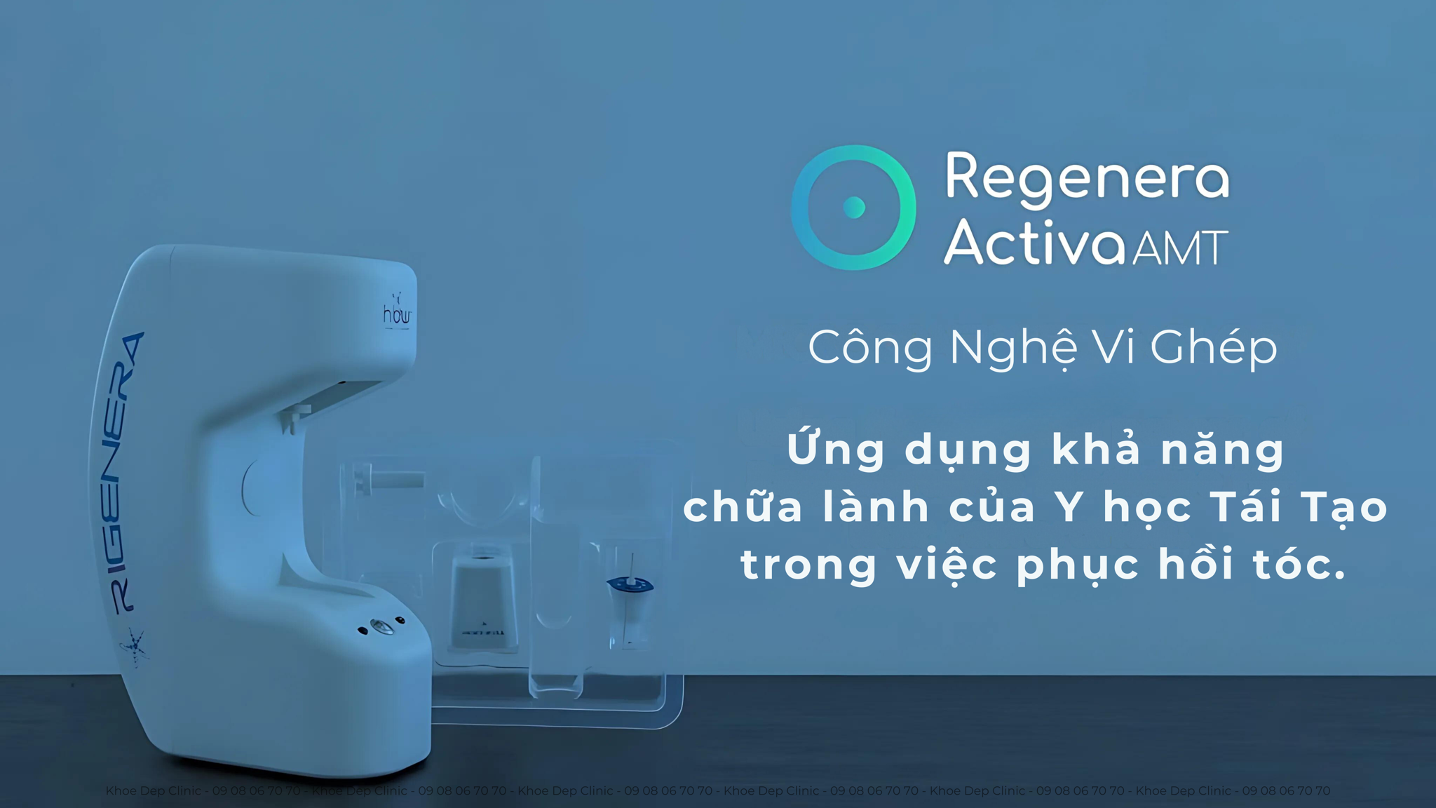 Phương pháp cấy tóc vi mô tự thân (AMT) là gì?