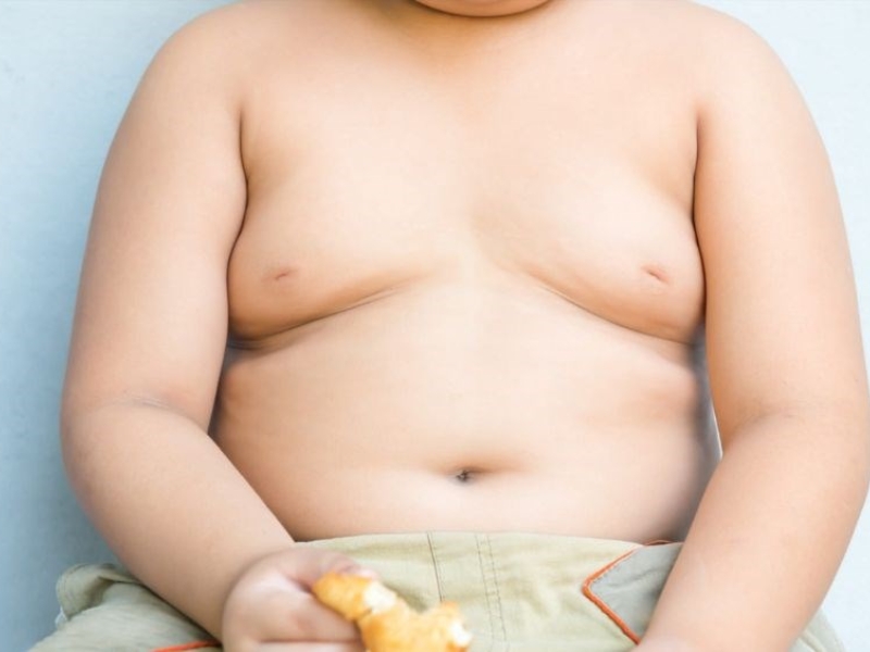 Bệnh béo phì là gì?