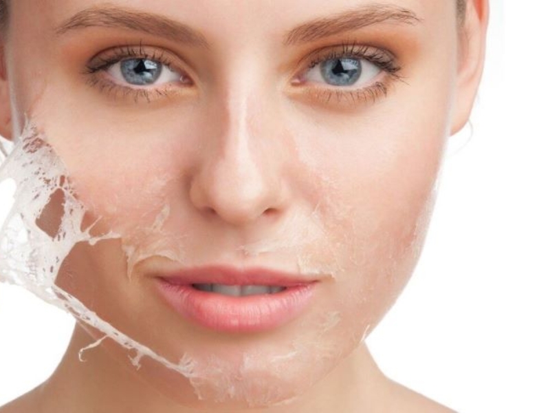 Các cách đẩy nhanh quá trình tái tạo da đơn giản