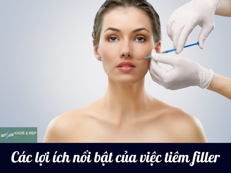 Ưu điểm của việc tiêm filler