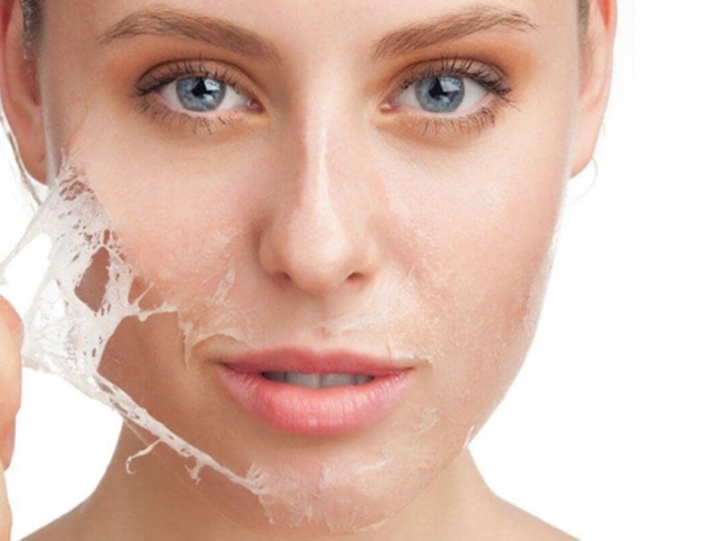 Các vấn đề thường gặp khi đi tái tạo làn da?