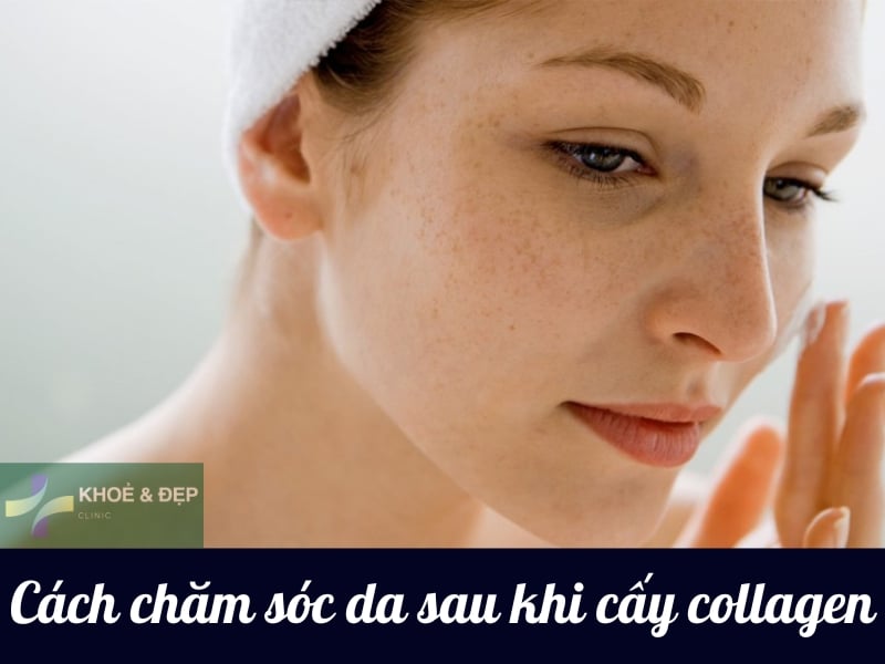 Chăm sóc da sau khi cấy collagen