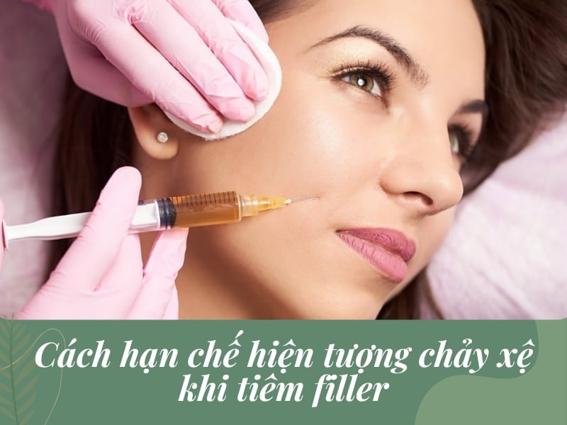 Cách hạn chế chảy xệ khi tiêm filler