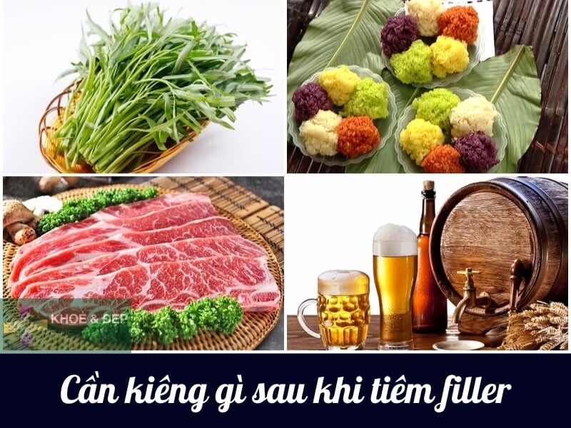 Chú ý kiêng cử sau khi tiêm