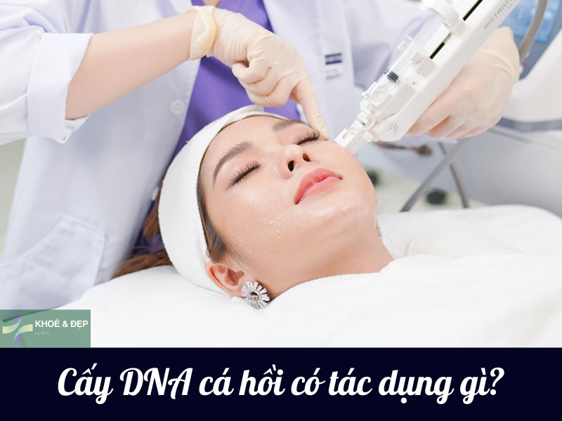 Cấy căng bóng da cá hồi có công dụng gì?