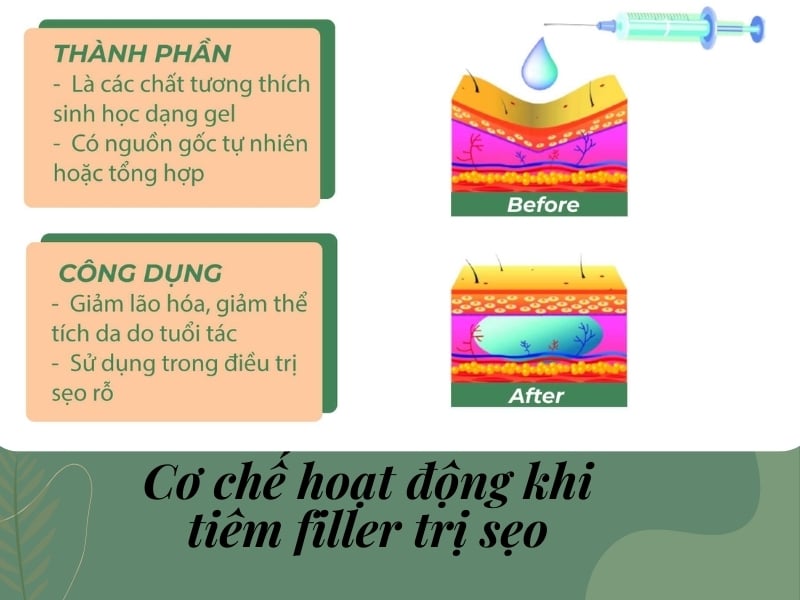 Cơ chế hoạt động khi tiêm filler trị sẹo