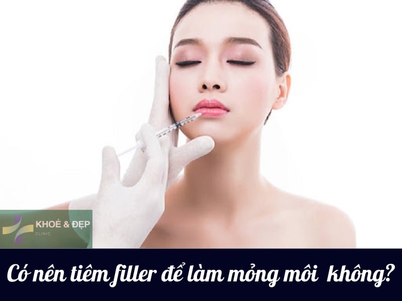 Có nên tiêm filler để làm mỏng môi dày hay không?