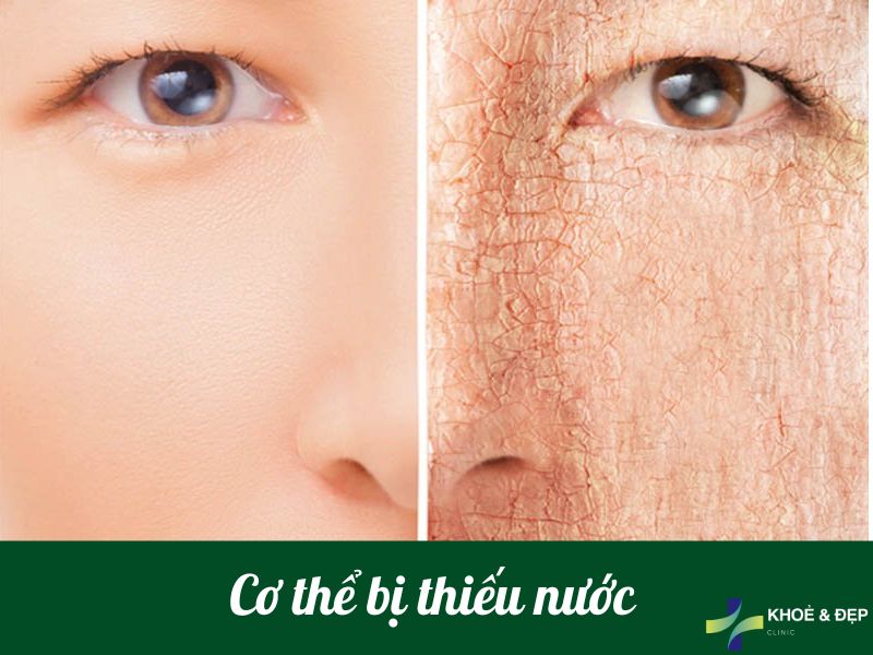 Cơ thể bị thiếu nước