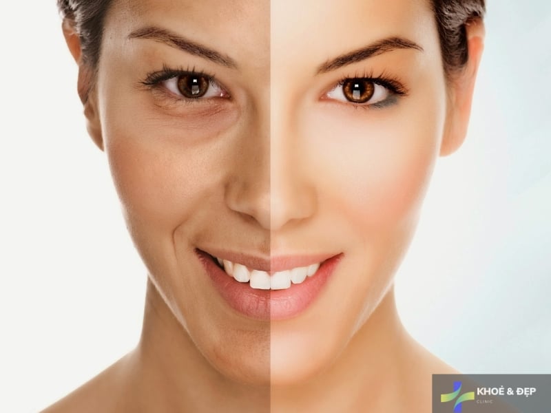 Công dụng của kem dưỡng da