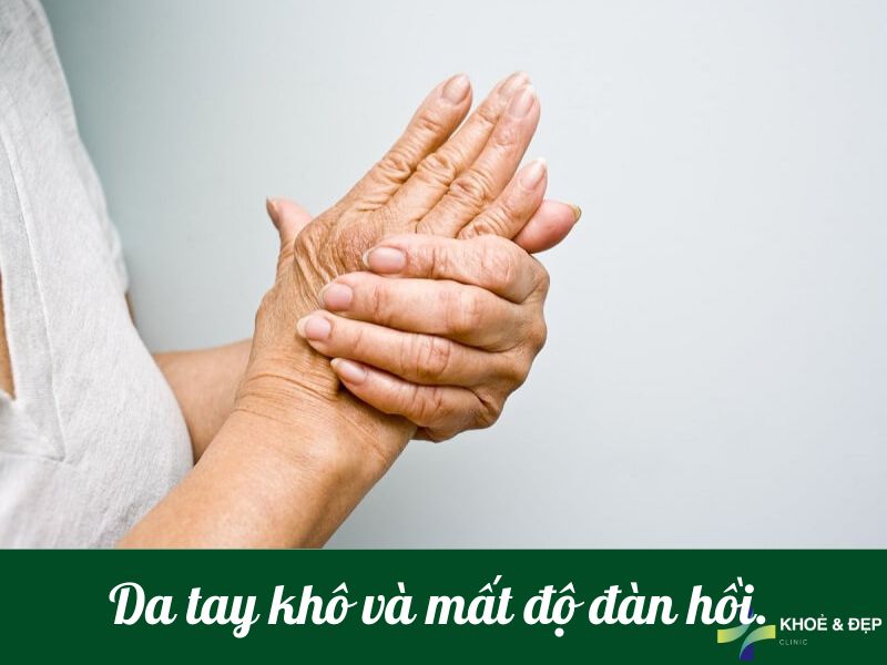 Da tay khô và mất đi tính đàn hồi