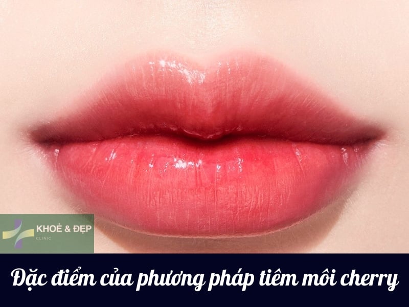 Đặc điểm của phương pháp tiêm filler môi cherry