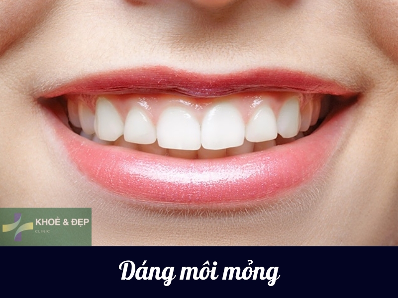 Dáng môi tiêm filler kiểu môi mỏng