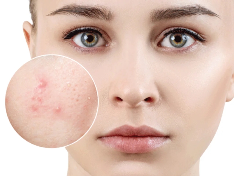 Dấu hiệu làn da hư tổn