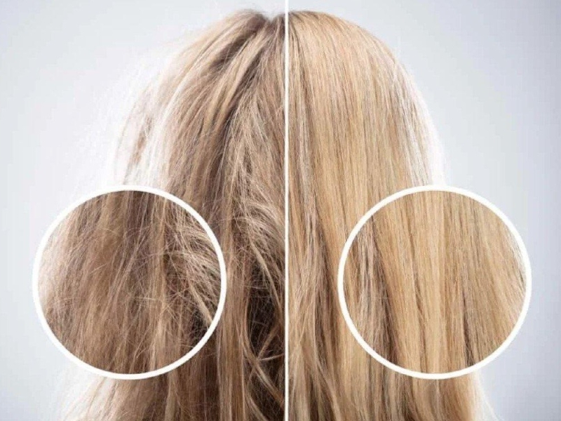 Dấu hiệu nhận biết tóc rụng