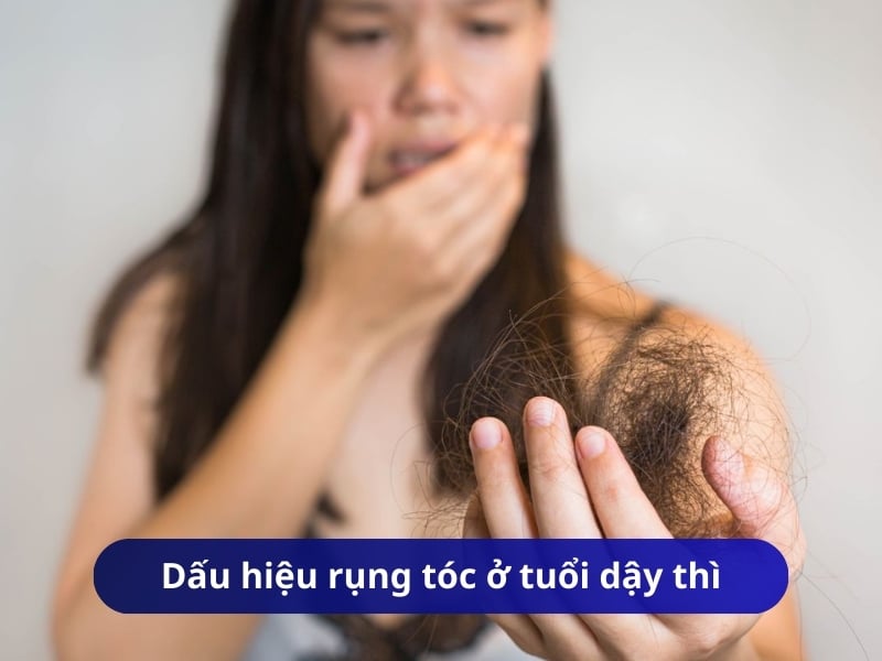 Dấu hiệu rụng tóc ở tuổi dậy thì