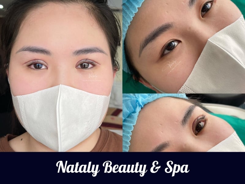 Địa chỉ tiêm filler uy tín, chất lượng tại Nghệ An - Nataly Beauty & Spa