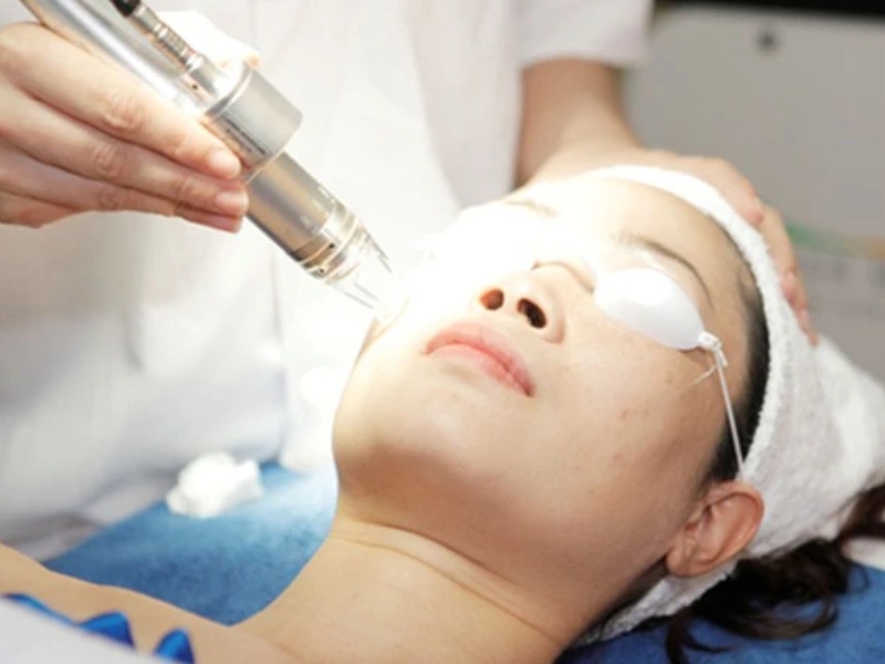 Điều trị sẹo bằng laser có hiệu quả không?