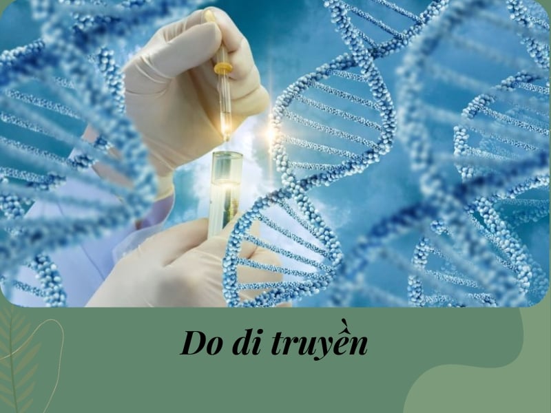 Do di truyền