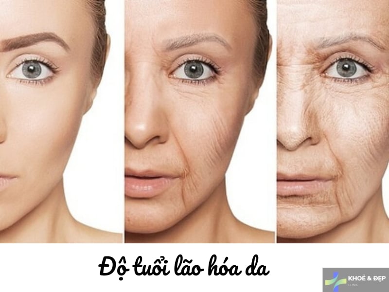 Tác động của thời gian