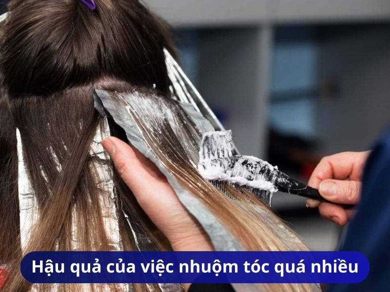 Hậu quả của việc nhuộm tóc quá nhiều