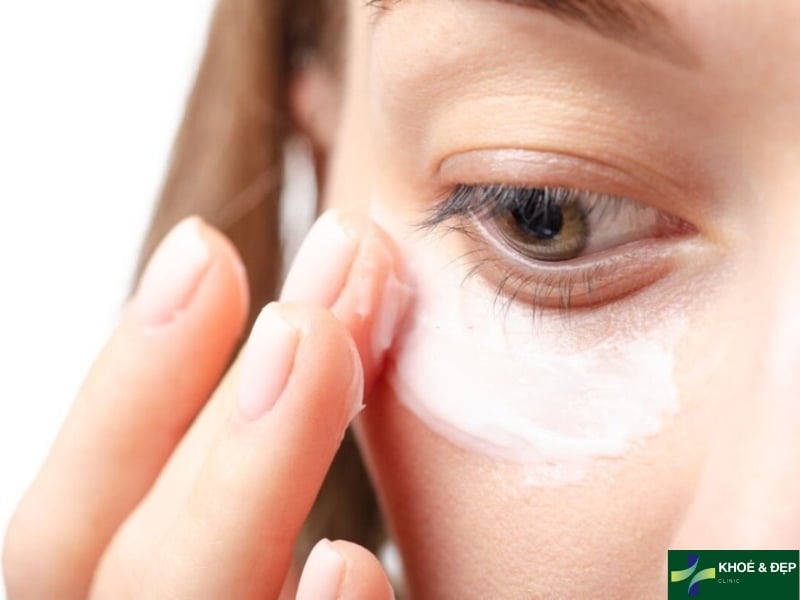 Kem dưỡng mắt chống lão hóa - Sức mạnh giữ tuổi thanh xuân cho vùng da mắt