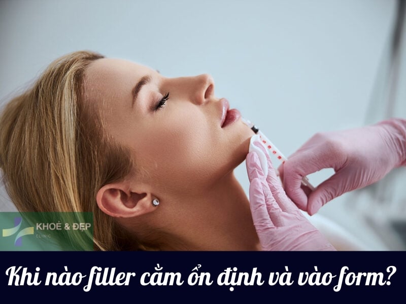 Khi nào cằm sẽ ổn định và vào form?