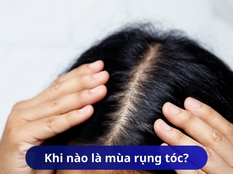 Khi nào là mùa rụng tóc?