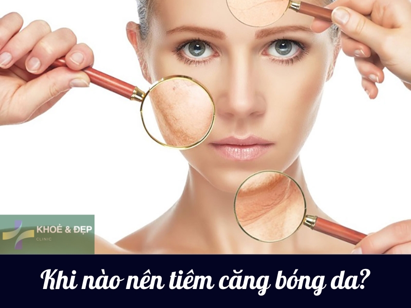 Khi nào nên thực hiện tiêm căng bóng da?