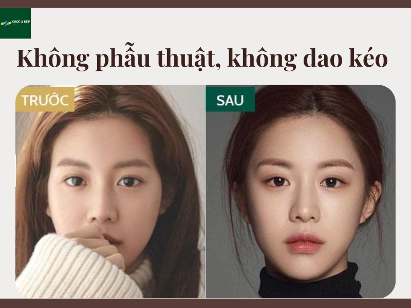 Không phẫu thuật, không dao kéo, không đau