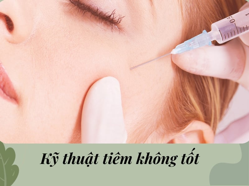 Kỹ thuật tiêm không tốt