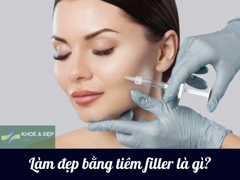 Phương pháp làm đẹp bằng tiêm filler là gì?