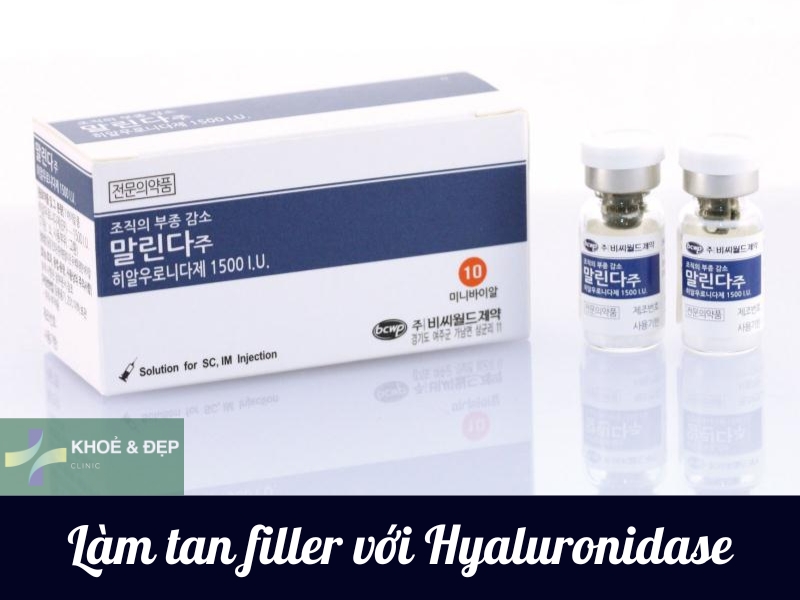 Tiêm tan filler là tiêm chất gì?