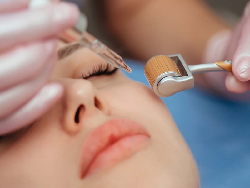 Lăn kim trị sẹo&nbsp;có an toàn không?