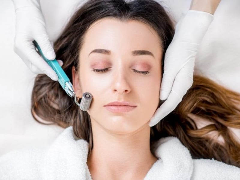 Lăn kim và peel da