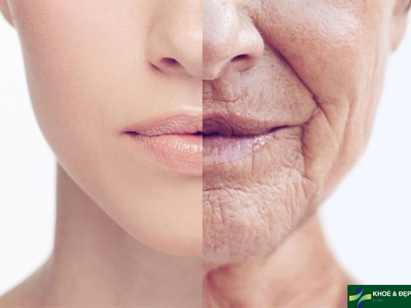 Lão hóa da là gì?