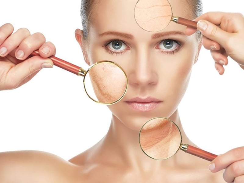 Lão hóa da là gì?