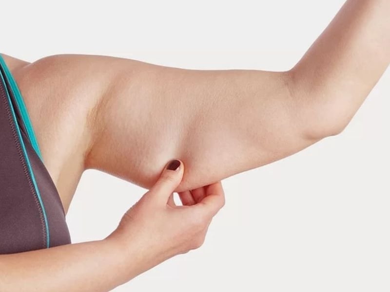 Lưu ý khi thực hiện giảm mỡ bắp tay hiệu quả