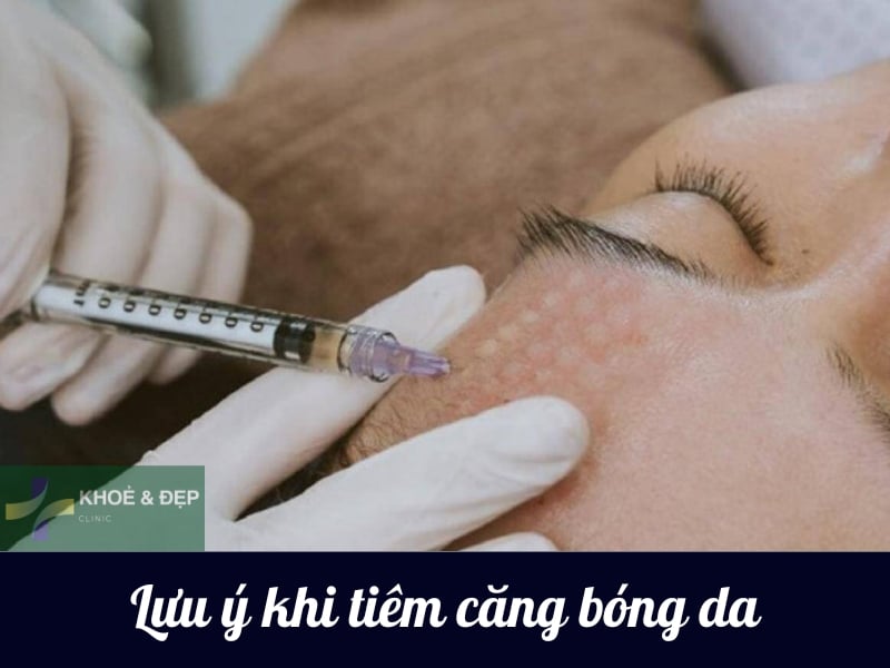 Lưu ý khi tiêm căng bóng da
