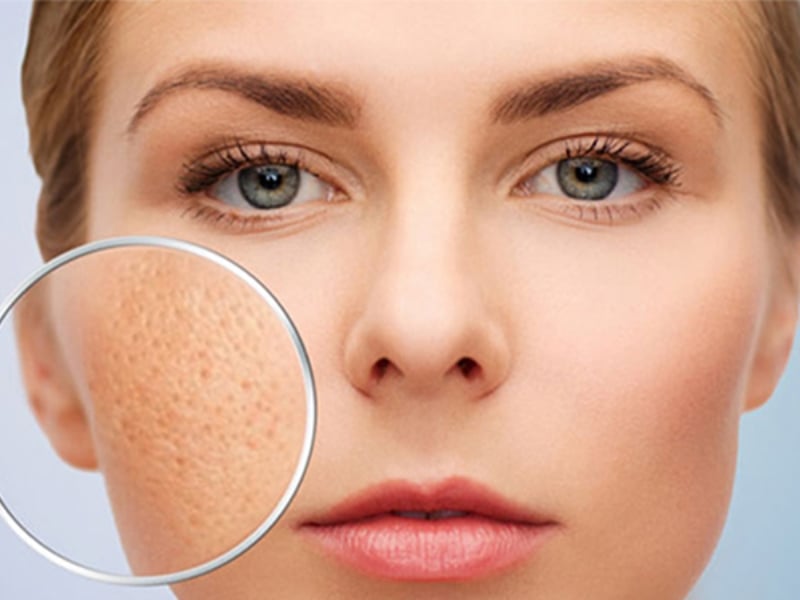 Lý do hình thành sẹo