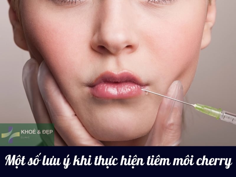 Một số lưu ý khi thực hiện tiêm môi cherry