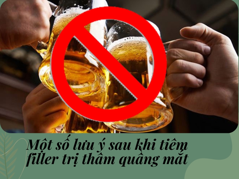 Một số lưu ý sau khi tiêm filler