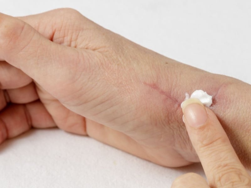 Một vài lưu ý khi dùng kem trị sẹo của Nhật