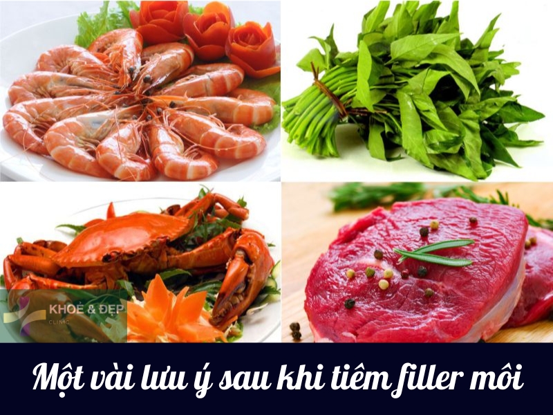 Một số lưu ý sau khi tiêm filler môi