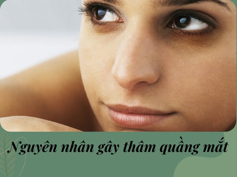 Nguyên nhân gây làm mắt thâm quầng