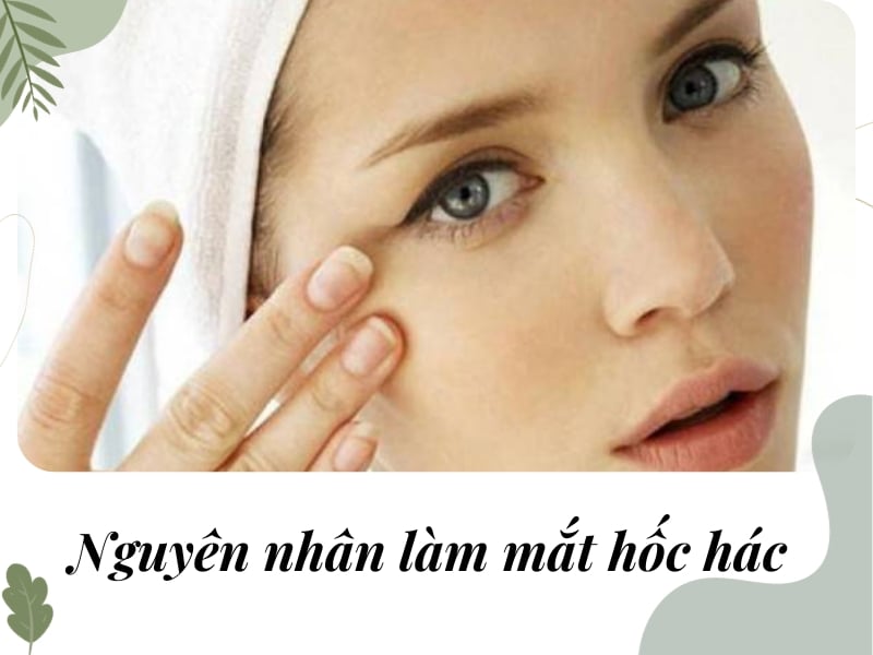 Nguyên nhân làm mắt hốc hác