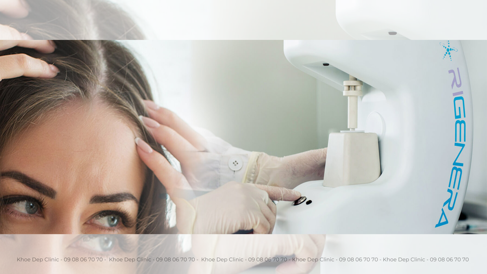 Phương pháp cấy tóc vi mô tự thân (AMT)