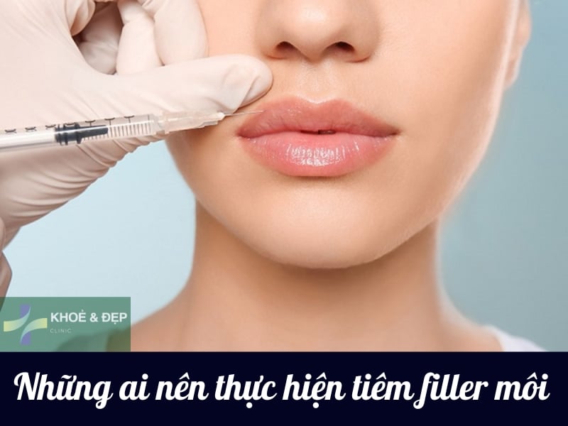 Những ai nên thực hiện tiêm môi filler?