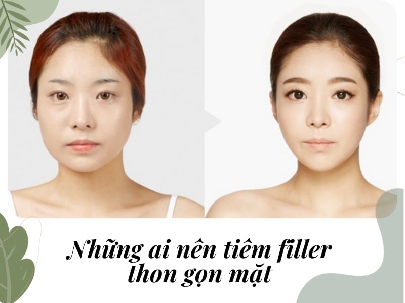 Những ai nên tiêm filler mặt?